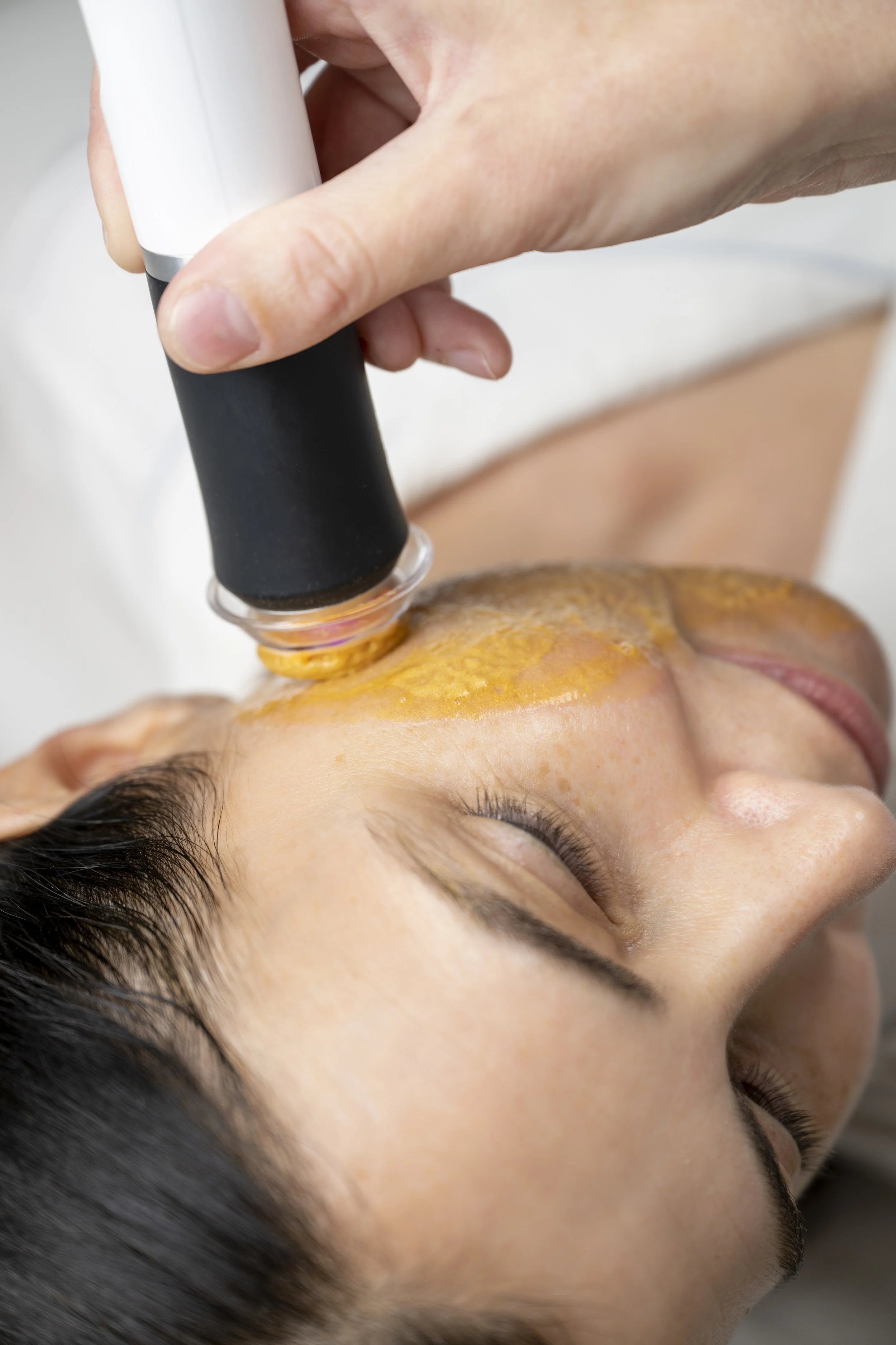GLO2 Oxygen Facial — Skinscapes Wellesley